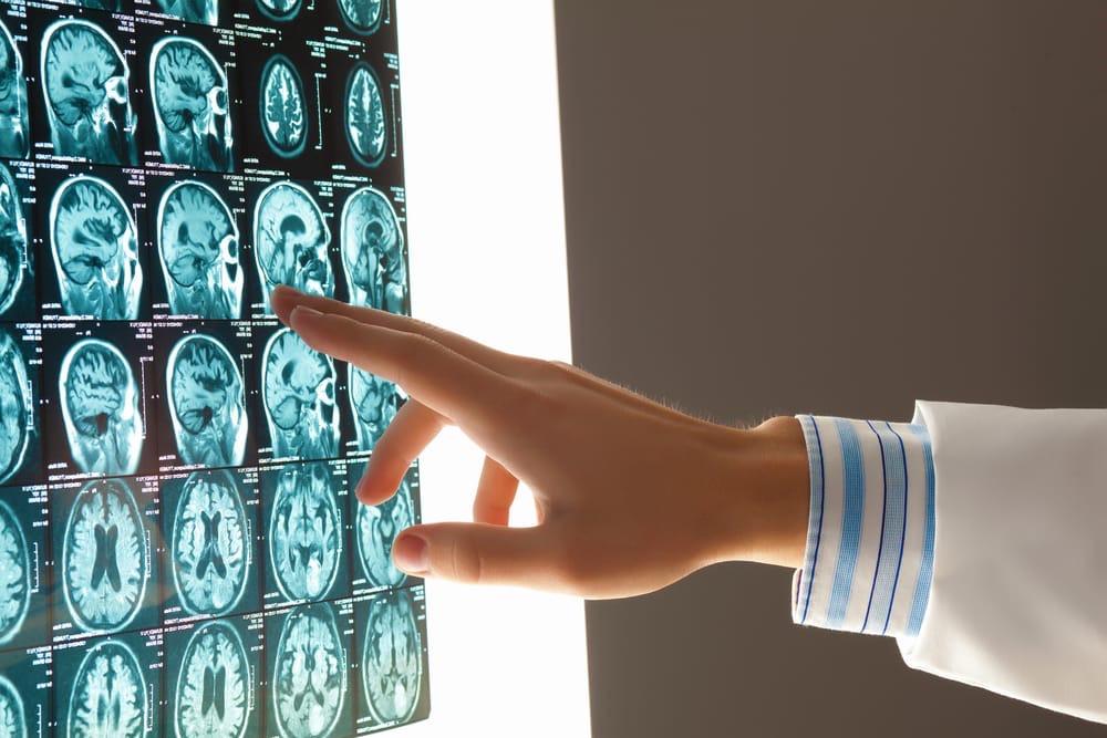 Grewer Law Group - Medical Malpractice - Brain Injury Grewer Law Group - Medical Malpractice - Brain Injury
